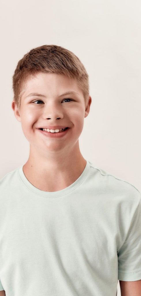 portrait of cheerful disabled boy with down syndrome smiling aside while posing isolated over white background